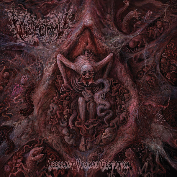 VULVECTOMY - Aberrant Vaginal Gestation - LP