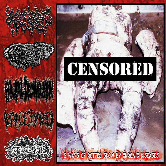 BRUTAL DECOMPOSITION / GRUESOME BODYPARTS AUTOPSY / ONCOLOGISTS / LARYNGECTOMIZED / FETAL DEFORMITY – 5 Ways Of Rotted Slow By Chronic Diseases - CD